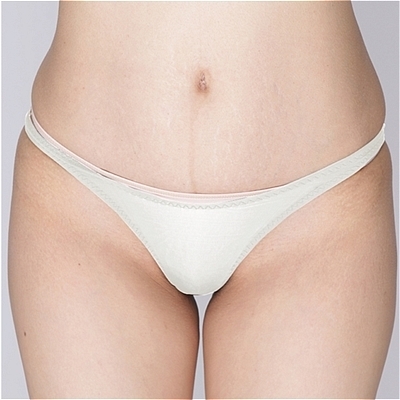 �ɔ��X�g���b�`�n�C���O�n�[�t�o�b�N�@�z���C�g�i�����j