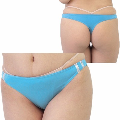 �Q�������X�g���b�`�u���}�s�o�b�N�@�^�[�R�C�Y�i�����j