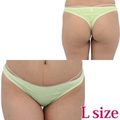 ���Ȃ��݂̗ǂ��R�b�g���V���v���s�o�b�N�k�@�O���[���i�����j